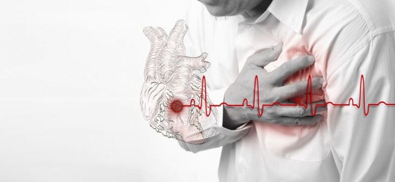 Ataque al corazón como causa de dolor debajo del omóplato izquierdo. 