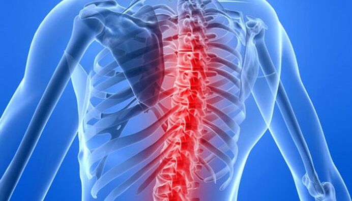 Las patologías de la columna son la causa más común de dolor de espalda en la zona de la escápula. 