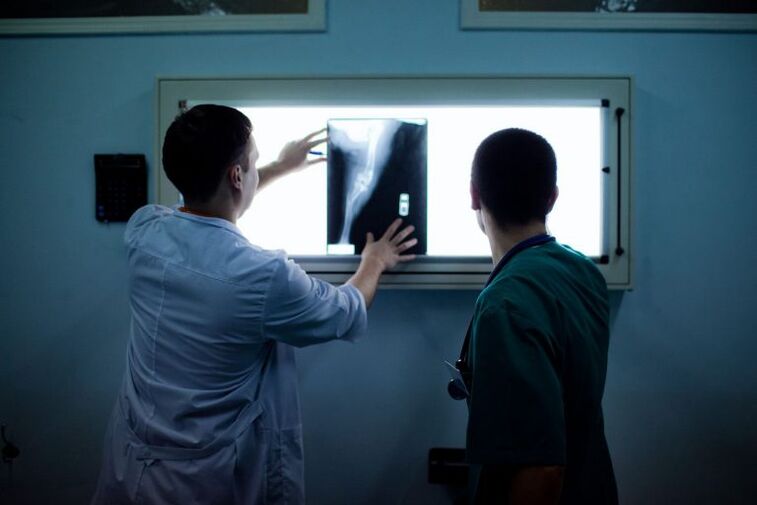 Diagnóstico de osteoartritis en rayos X