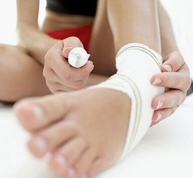Unido con osteoartritis