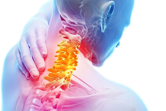 Osteocondrosis cervical